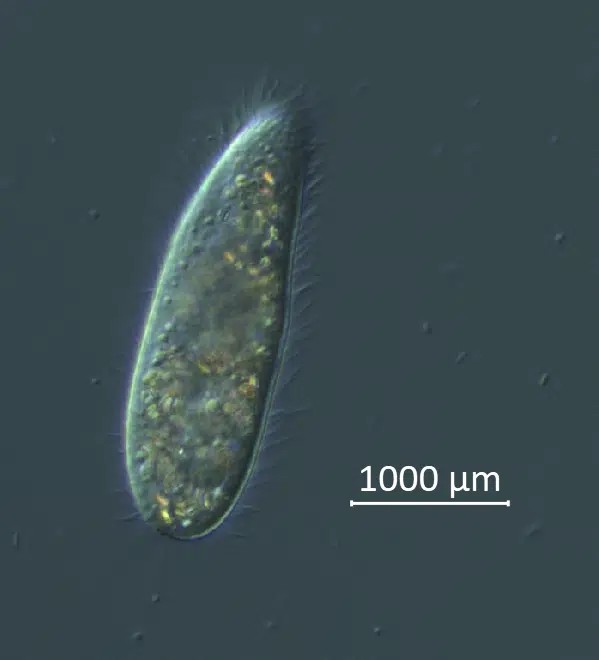 Foto microscópica de un ciliado. - Foto Mya Breitbart/University of South Florida College of Marine Science/AP